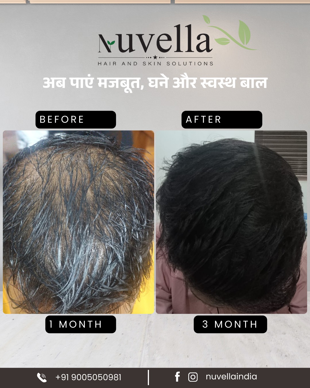Before and After - 3 months