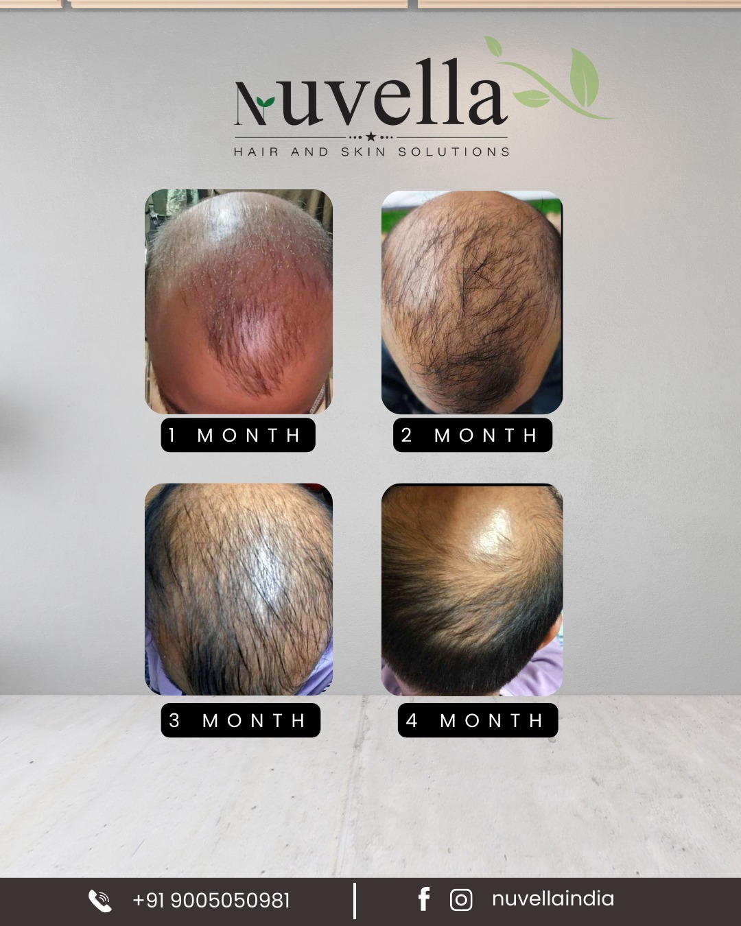 Before and After - 4 months